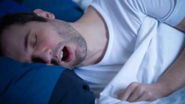 OSA (Obstructive Sleep Apnea)