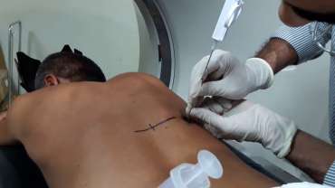 Pleural Biopsy