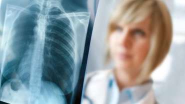 Pneumothorax