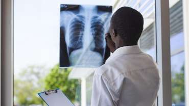 Pulmonary Embolism