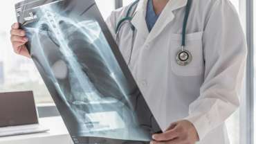 Pulmonary Hypertension